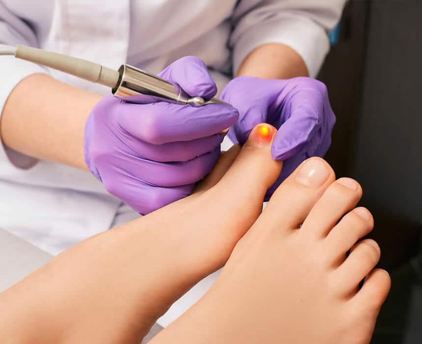 A professional administering nail fungus treatment on a person's foot